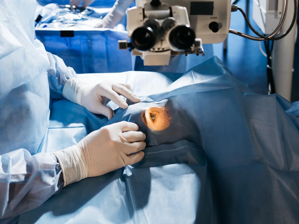 Laser Eye Surgery